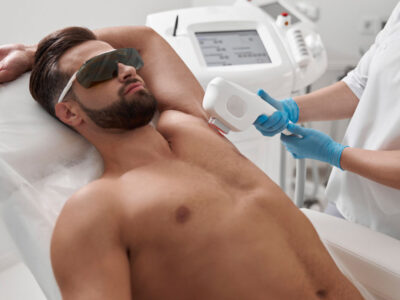 Under Arms Laser Waxing