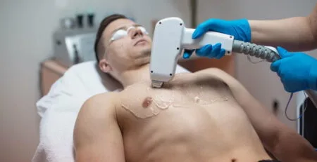 Man's Guide to Laser Hair Removal