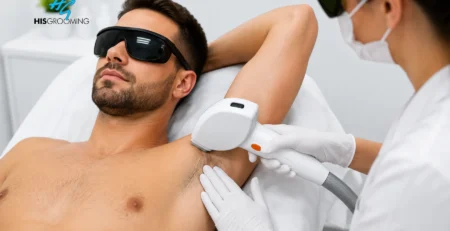 Man receiving laser hair removal treatment on his underarm while wearing protective goggles in a modern clinic.